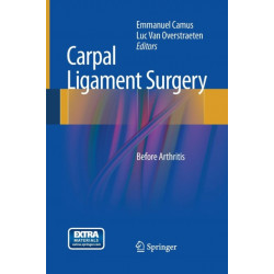 Carpal Ligament Surgery: Before Arthritis
