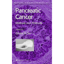 Pancreatic Cancer: Methods and Protocols