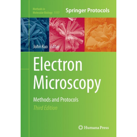 Electron Microscopy: Methods and Protocols