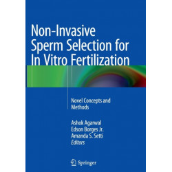 Non-Invasive Sperm Selection for In Vitro Fertilization: Novel Concepts and Methods