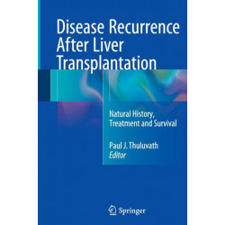 Disease Recurrence After Liver Transplantation: Natural History, Treatment and Survival