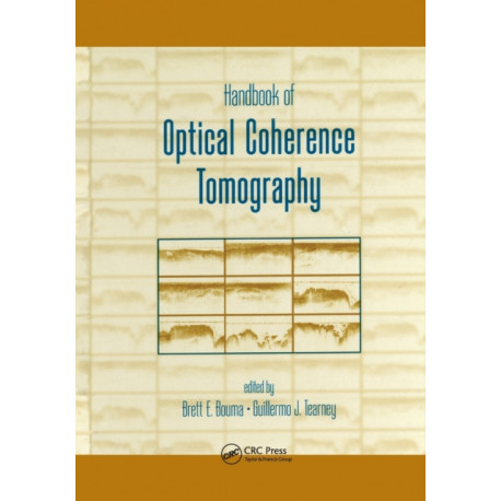 Handbook of Optical Coherence Tomography