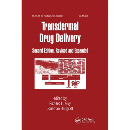 Transdermal Drug Delivery Systems: Revised and Expanded