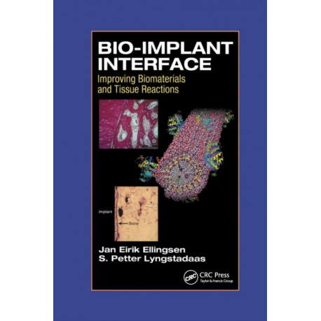 Bio-Implant Interface: Improving Biomaterials and Tissue Reactions