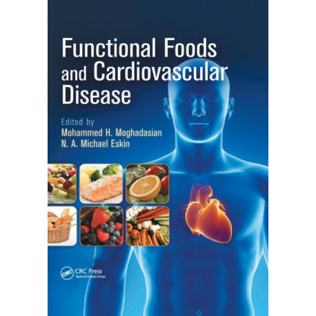 Functional Foods and Cardiovascular Disease