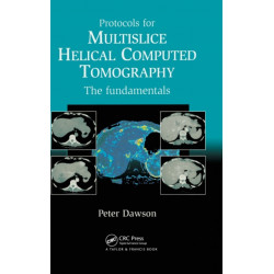 Protocols for Multislice Helical Computed Tomography: The Fundamentals