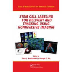 Stem Cell Labeling for Delivery and Tracking Using Noninvasive Imaging