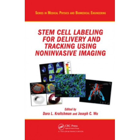 Stem Cell Labeling for Delivery and Tracking Using Noninvasive Imaging