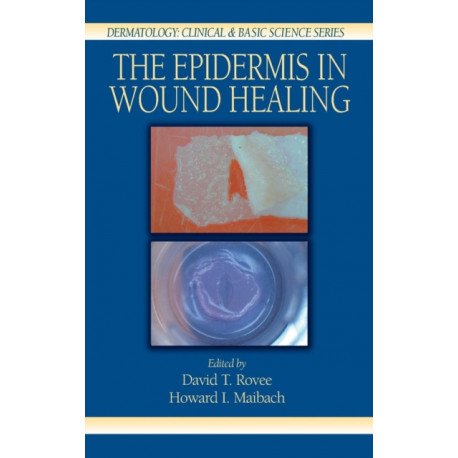 The Epidermis in Wound Healing