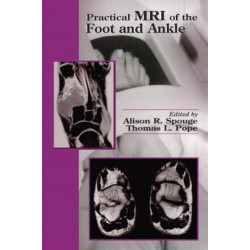 Practical MRI of the Foot and Ankle