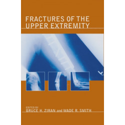 Fractures of the Upper Extremity