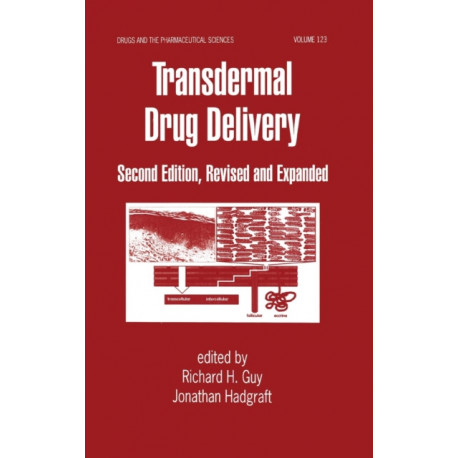 Transdermal Drug Delivery Systems: Revised and Expanded
