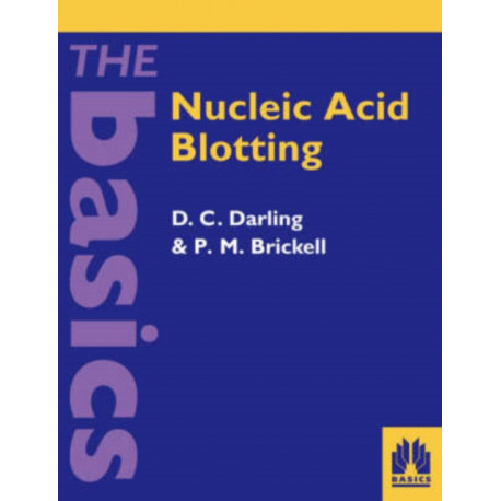 Nucleic Acid Blotting: The Basics