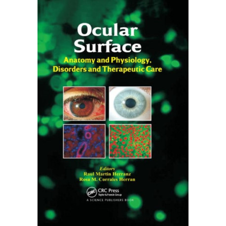 Ocular Surface: Anatomy and Physiology, Disorders and Therapeutic Care