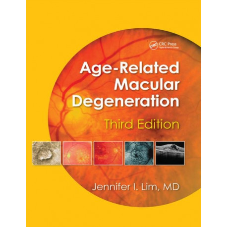 Age-Related Macular Degeneration, Third Edition
