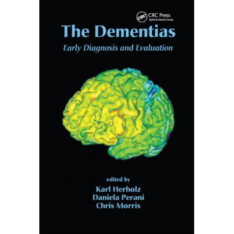 The Dementias: Early Diagnosis and Evaluation