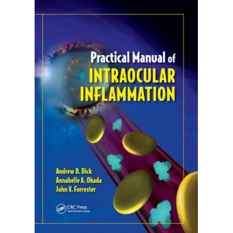 Practical Manual of Intraocular Inflammation