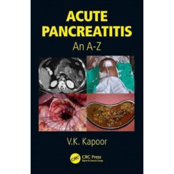 Acute Pancreatitis: An A-Z