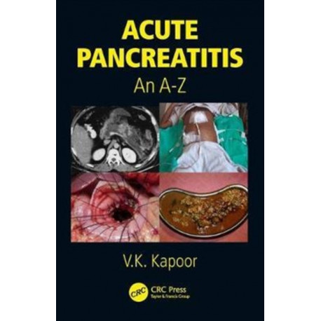 Acute Pancreatitis: An A-Z