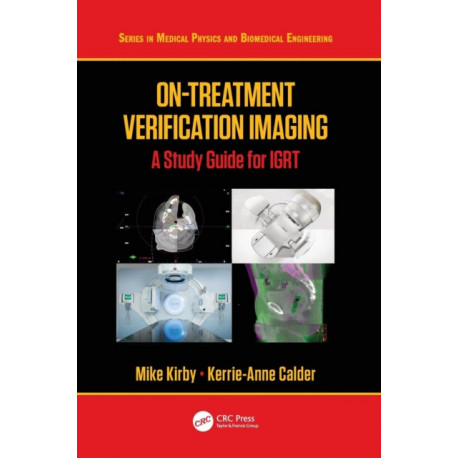 On-Treatment Verification Imaging: A Study Guide for IGRT