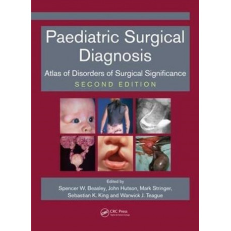 Paediatric Surgical Diagnosis: Atlas of Disorders of Surgical Significance, Second Edition