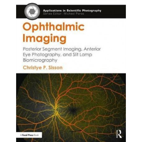 Ophthalmic Imaging: Posterior Segment Imaging, Anterior Eye Photography, and Slit Lamp Biomicrography