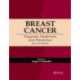 Breast Cancer: Prognosis, Treatment, and Prevention
