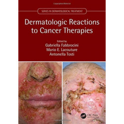 Dermatologic Reactions to Cancer Therapies