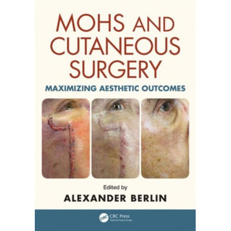 Mohs and Cutaneous Surgery: Maximizing Aesthetic Outcomes