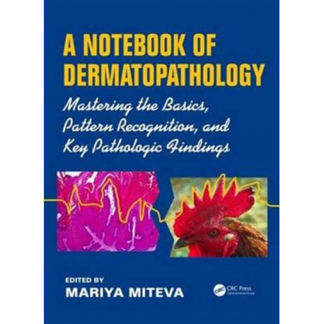 A Notebook of Dermatopathology: Mastering the Basics, Pattern Recognition, and Key Pathologic Findings