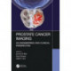 Prostate Cancer Imaging: An Engineering and Clinical Perspective