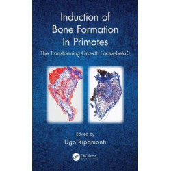 Induction of Bone Formation in Primates: The Transforming Growth Factor-beta 3