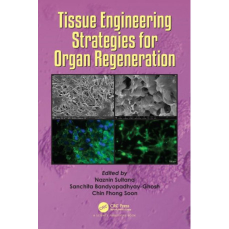 Tissue Engineering Strategies for Organ Regeneration
