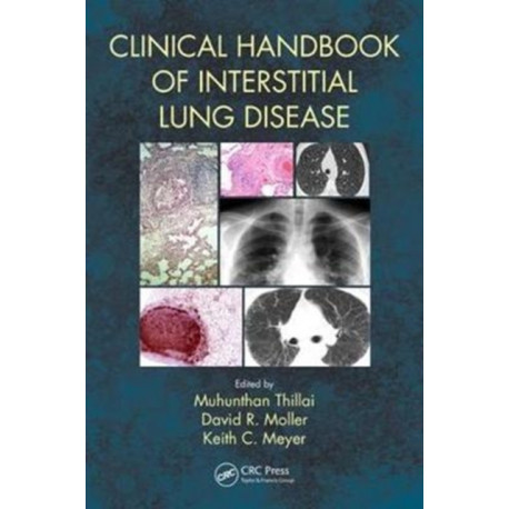 Clinical Handbook of Interstitial Lung Disease