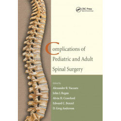 Complications of Pediatric and Adult Spinal Surgery