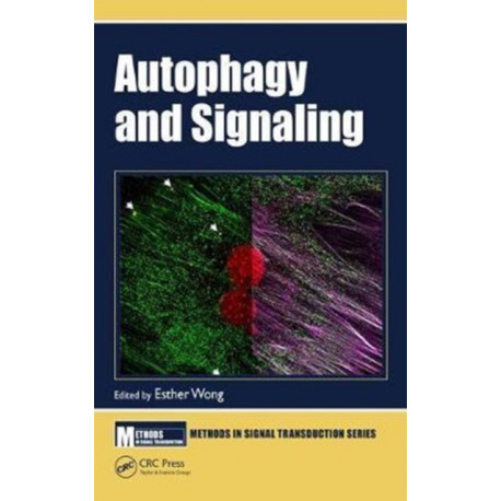 Autophagy and Signaling