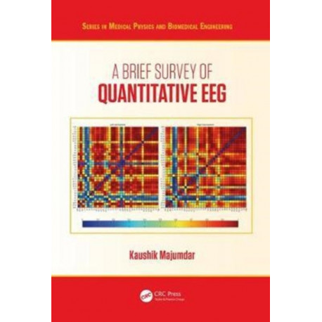 A Brief Survey of Quantitative EEG