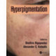 Hyperpigmentation