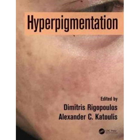 Hyperpigmentation