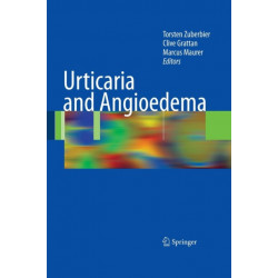 Urticaria and Angioedema