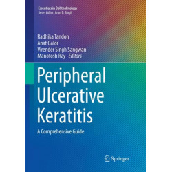 Peripheral Ulcerative Keratitis: A Comprehensive Guide