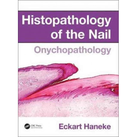 Histopathology of the Nail: Onychopathology
