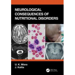Neurological Consequences of Nutritional Disorders