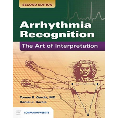 Arrhythmia Recognition: the Art of Interpretation: The Art of Interpretation