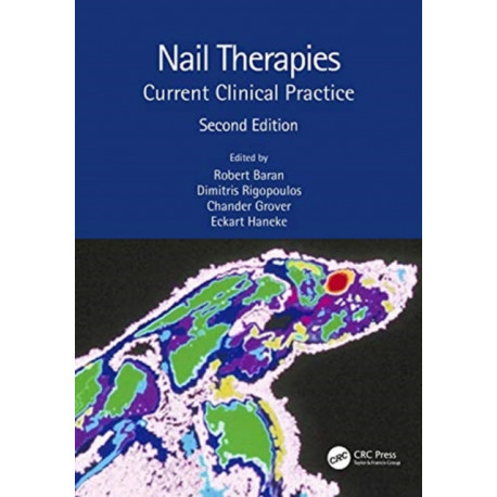 Nail Therapies: Current Clinical Practice
