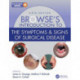 Browse's Introduction to the Symptoms & Signs of Surgical Disease
