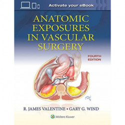 Anatomic Exposures in Vascular Surgery