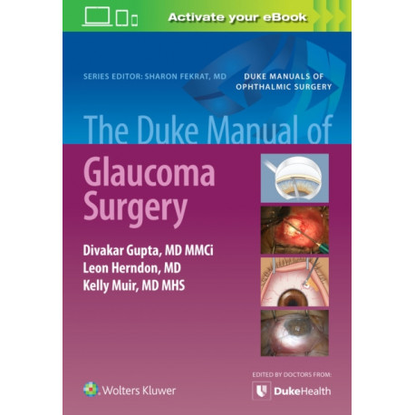 The Duke Manual of Glaucoma Surgery