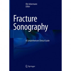 Fracture Sonography: A Comprehensive Clinical Guide