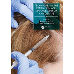 Techniques in the Evaluation and Management of Hair Diseases